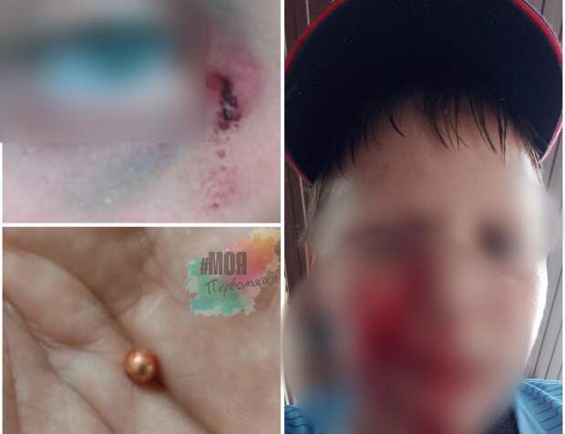 Подросток выстрелил в лицо школьника – Бастрыкин поручил возбудить дело