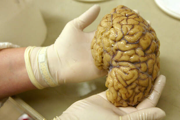 Ученым впервые удалось «оживить» мозг после глубокой заморозки