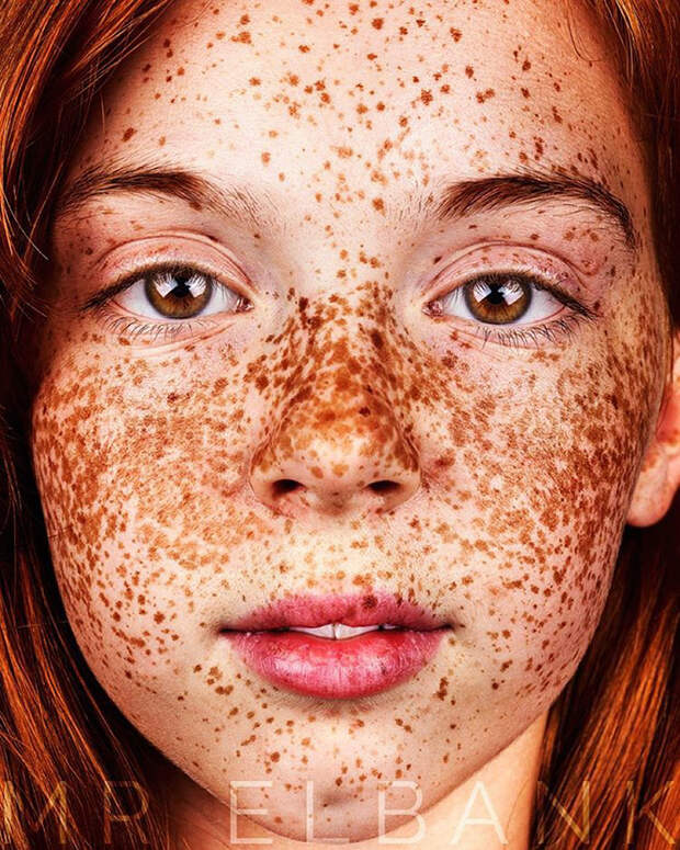 freckles-portrait-photography-brock-elbank-133__700