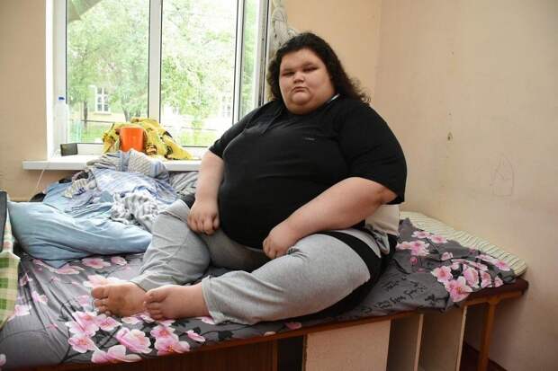 Мальчик из Воронежской области весит 260 кг
