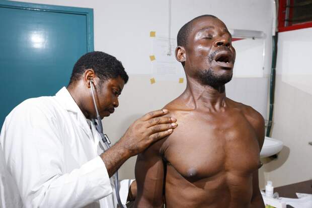 В Африке бушует штамм mpox: С января 2024 года около 3,1 тыс. человек заболели оспой обезьян