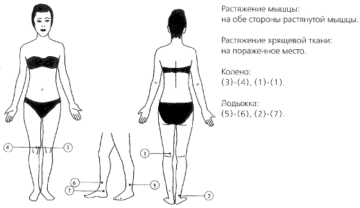 растяжение мышц, растяжение хрящевой ткани , колено, лодыжка.