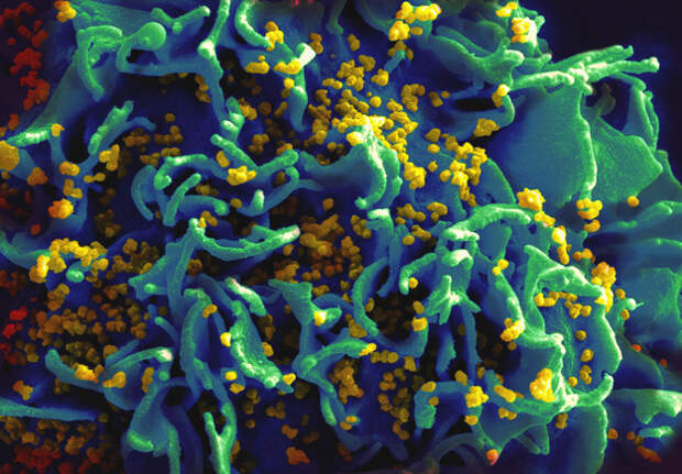 3. Bill Gates Just Gave $6 Million To Genetically Engineer An HIV Vaccine