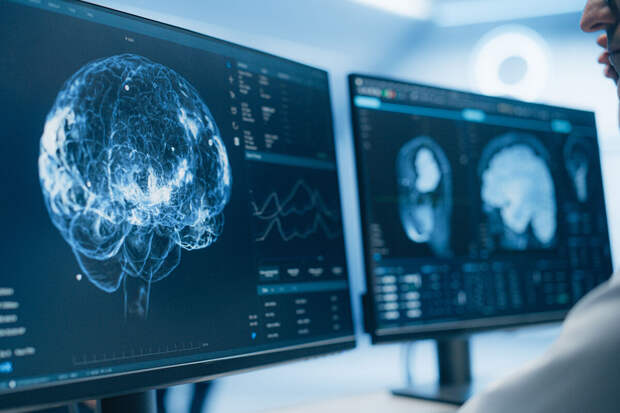 General Psychiatry: депрессия может быть признаком заболеваний мозга у пожилых