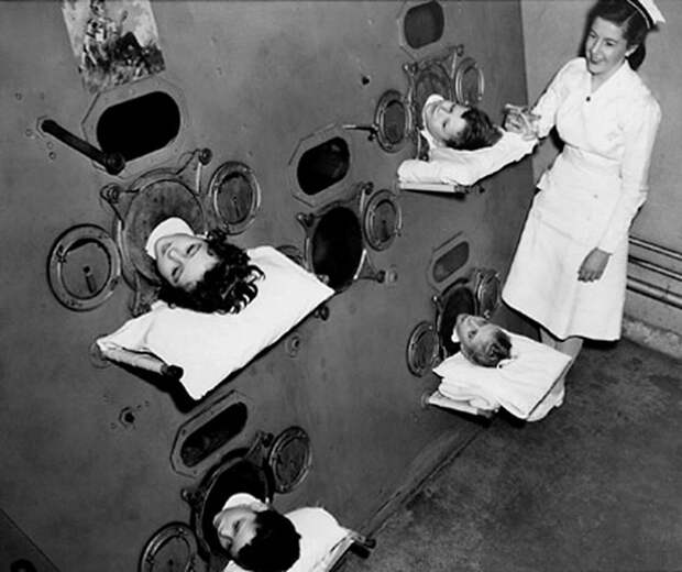 15. Аппарат "Железные легкие", приблизительно 1950 год. До изобретения вакцины от полиомиелита маленьких больных помещали в аппарат "железные легкие", который симулировал дыхание.