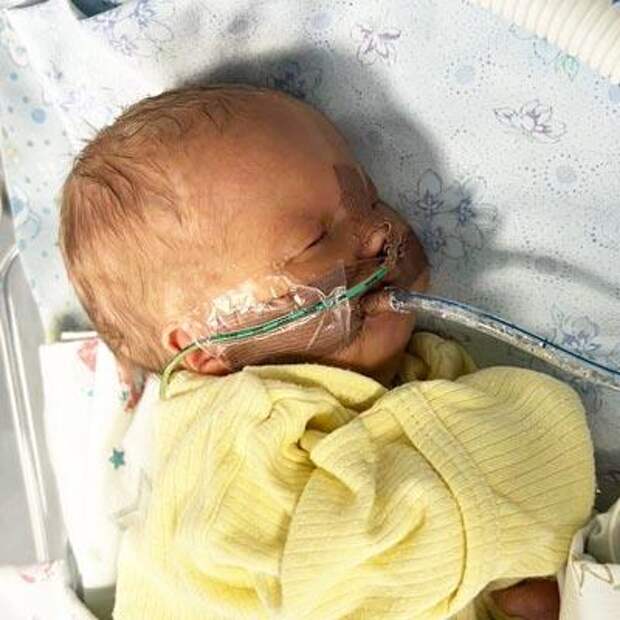 Дима Грызлов, 14 дней, критический врожденный порок сердца, спасет операция, 532 510 ₽