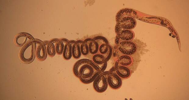 Heligmosomoides roundworm