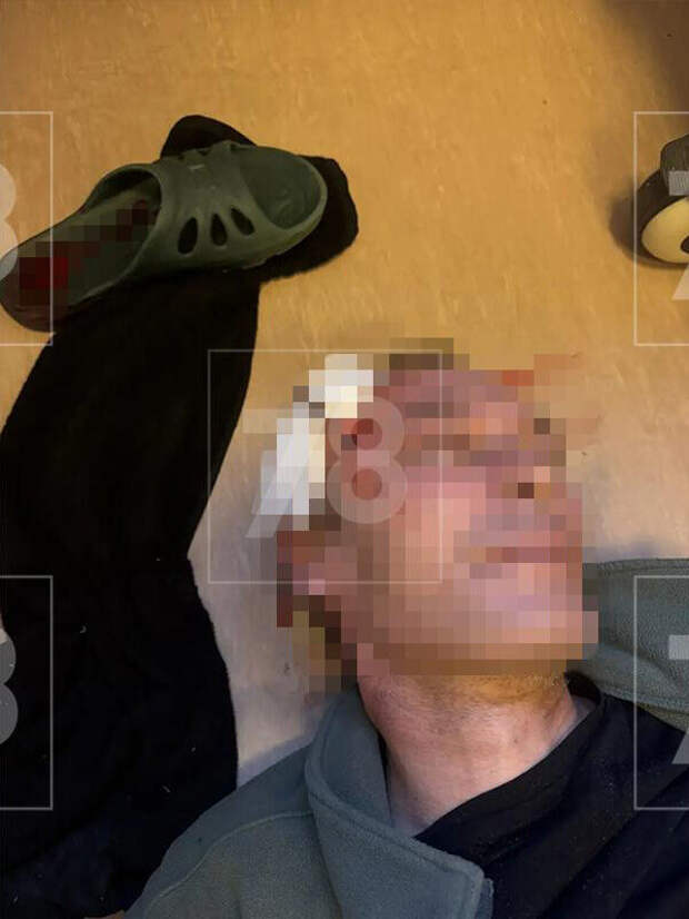 В Петербурге нашли военного с воткнутым в голову столовым прибором