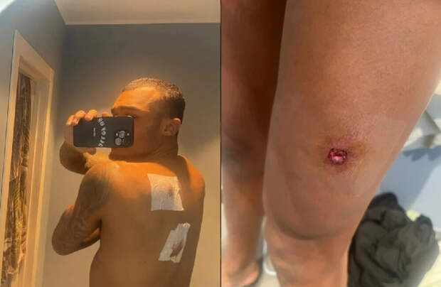 Стреляли в воспитанника ЦСКА: от 5 пуль из 6 ранения. Что известно? — Россия-2025