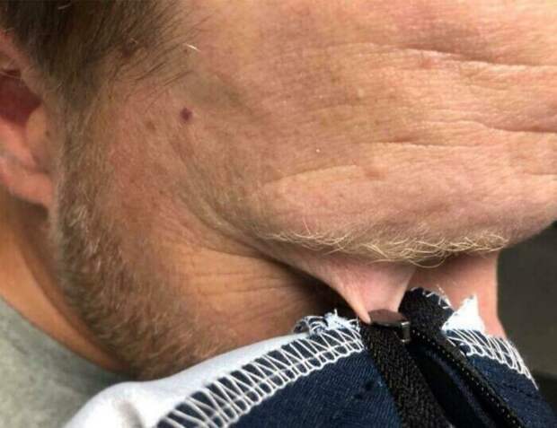 Незадача и невезение Незадача и невезение