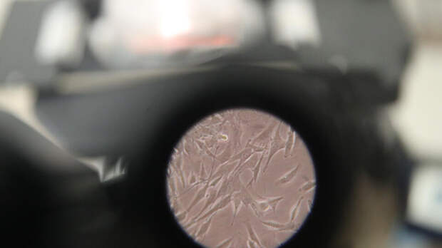 Наночастицы в виде гантелей найдут и "убьют" опухоль одномоментно