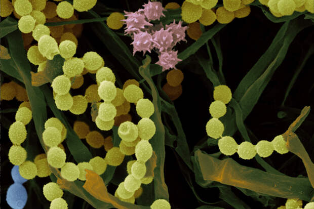 Разнообразие микроорганизмов, грибков и бактерий разлагает растительные компоненты в компост. Фото: East News