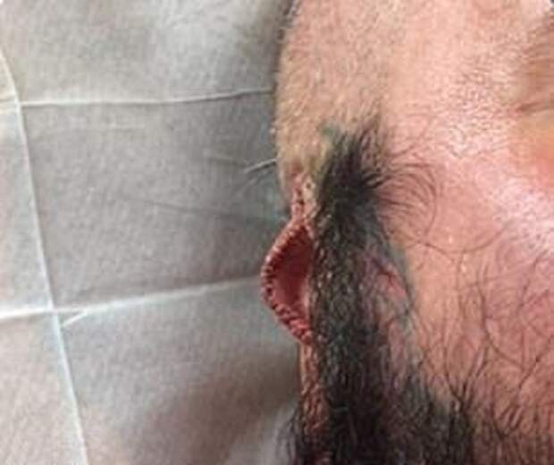 50-летний татуировщик кромсал уши, соски и языки клиентов