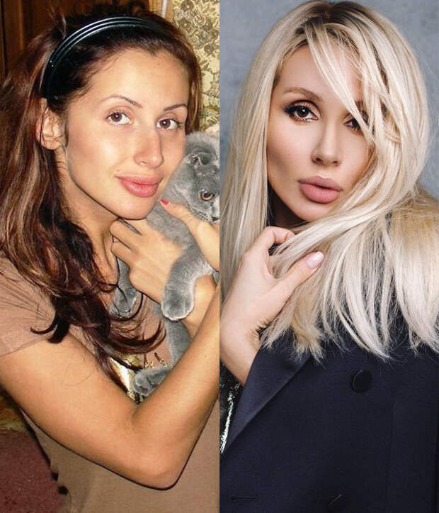 Светлана Лобода фото до и после пластики