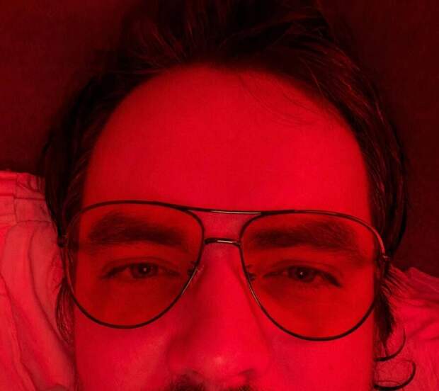 Стример Мэддисон: пришло время заняться бихакингом из-за морщин и отеков