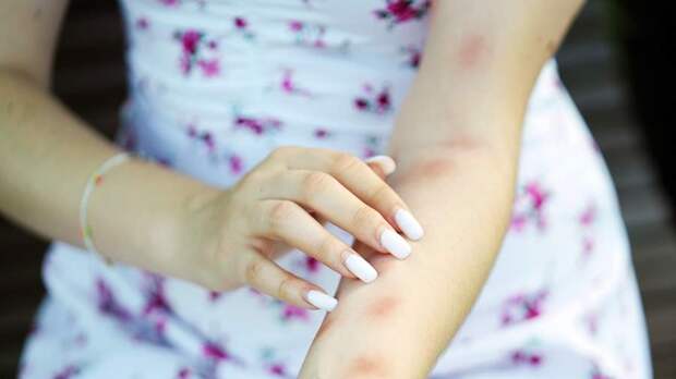 Врачи рассказали о новом методе диагностики атопического дерматита