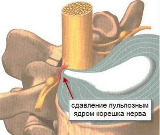 Почему стало модно лежать на валике из полотенца и так ли это полезно для спины?