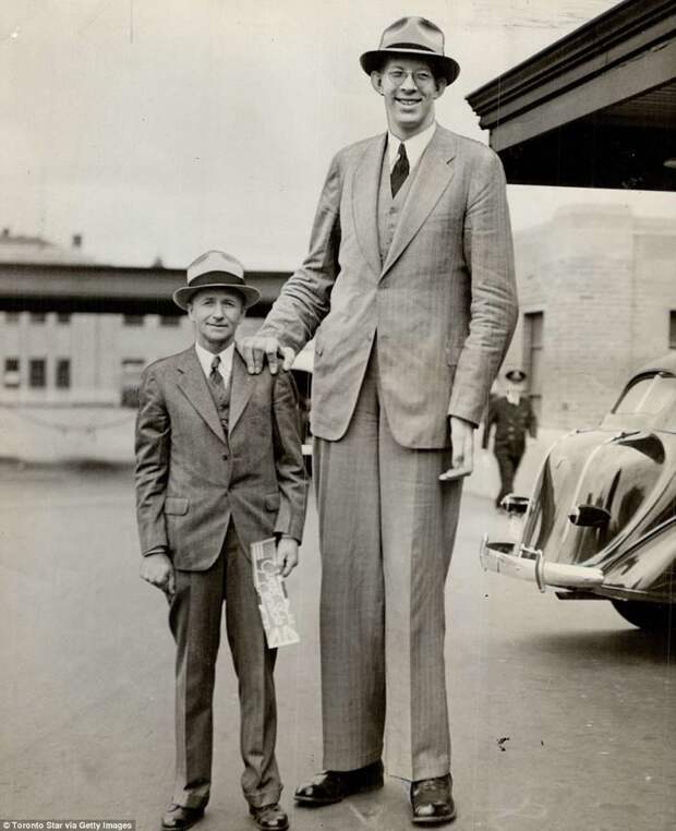 В 19 лет рост Роберта достиг уже 254 см. По сравнению с ним его отец со своими 180 см кажется лилипутом акромегалия, великан, опухоль, рекорд, рекорд гиннесса, рекордсмен Гинесса, самый высокий, самый высокий человек
