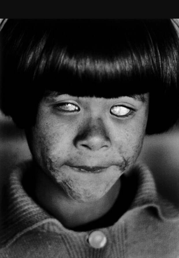 Так выглядят глаза человека который видел вспышку атомного взрыва #Фотографии, #история, #факты, .война
