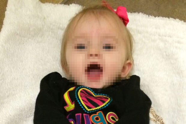 В США девочка перенесла 148 переломов из-за остеогенеза