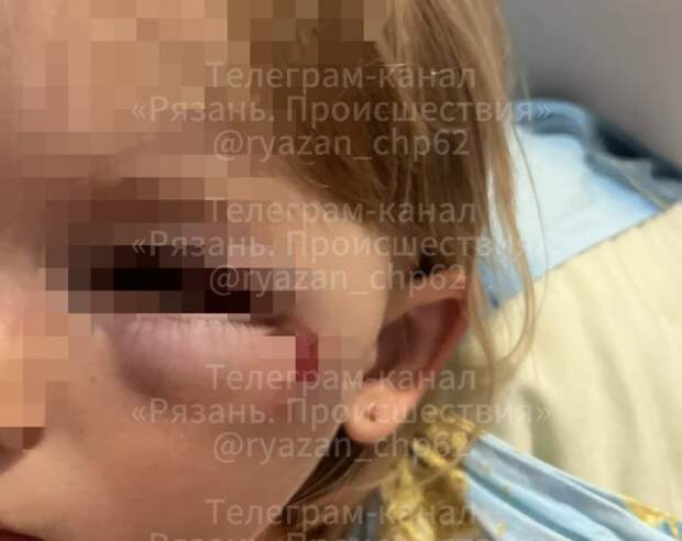 Курьер сбил 5-летнюю девочку на электросамокате в Рязани, у ребенка ЧМТ