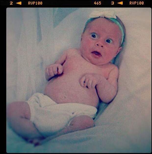 WorstBabyPhotos16 Эти ужасные младенцы