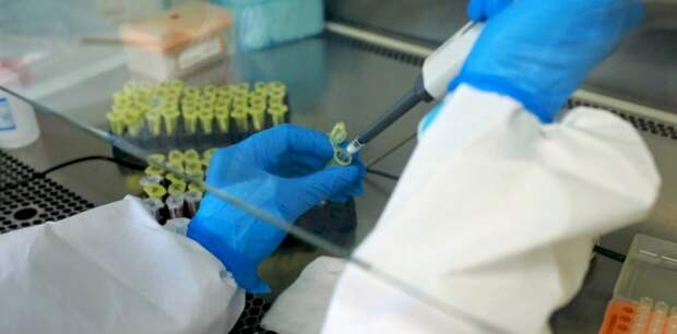 Сибирские вирусологи рассказали, под какие болезни маскируется оспа обезьян