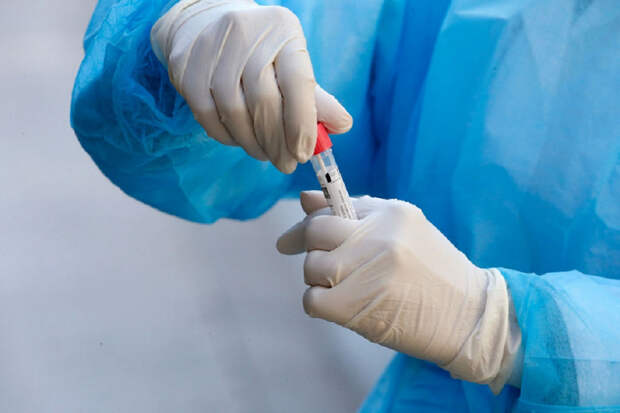 На Кубани у 87 человек подтвердился коронавирус