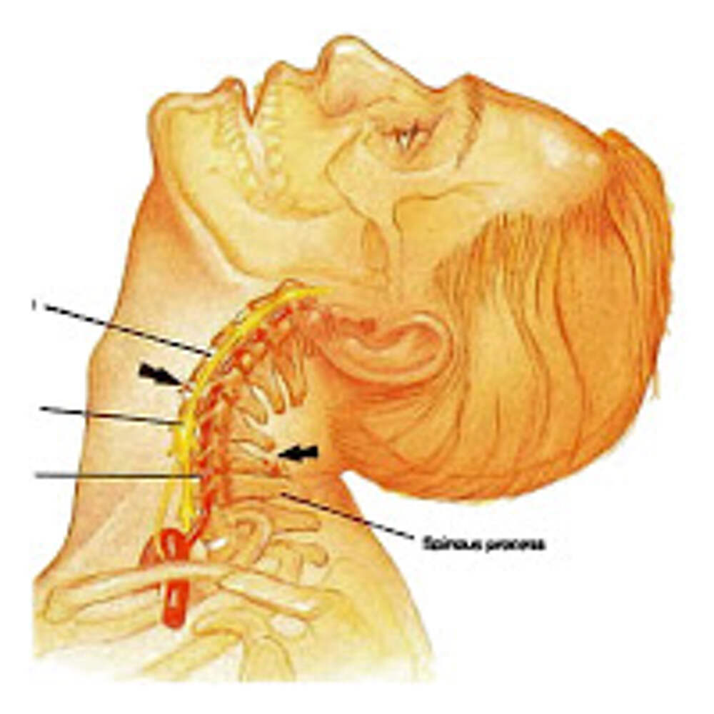 Шейный остеохондроз. Позвоночник шея. Остеохондроз шейного отдела позвоночника. Боль в шейном отделе.