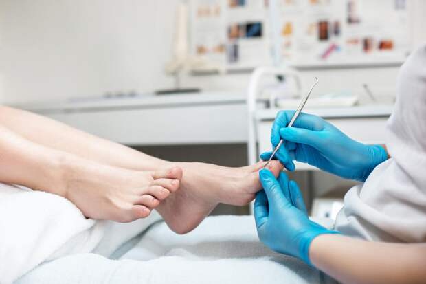 Где я лечила вросший ноготь в Москве