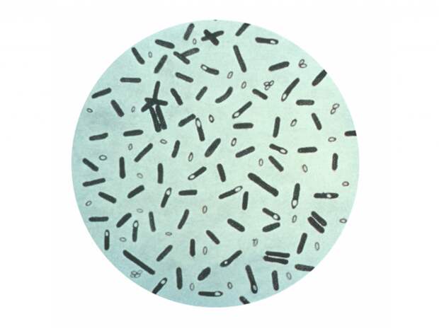Clostridium botulinum.png Clostridium botulinum.png