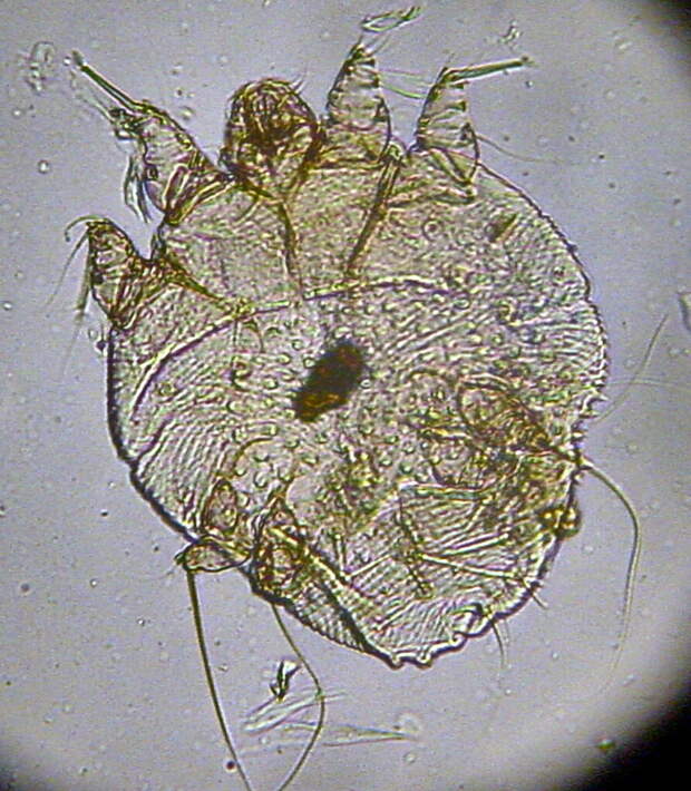 sarcoptes scabei 2