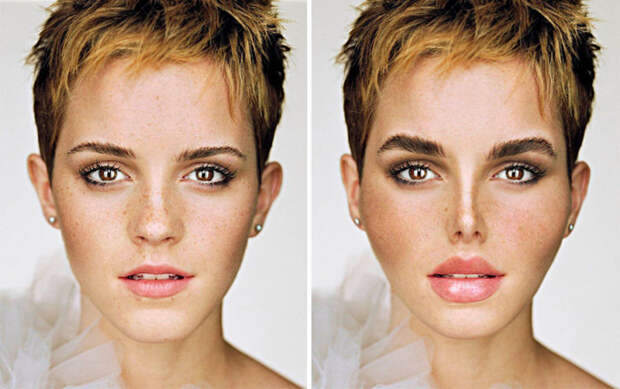 Так после пластических операций выглядела бы Эмма Уотсон (Emma Watson) - актриса, сыгравшая Гермиону Грейнджер в фильмах о Гарри Поттере.