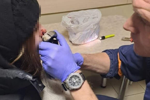 В Новосибирске спасли школьницу, у которой в носу застрял пирсинг