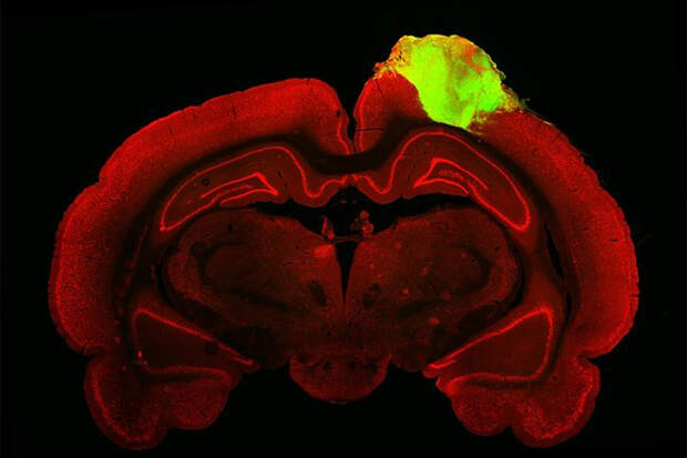 Nature: воспаление нейронов мозга помогает создавать долговременные воспоминания