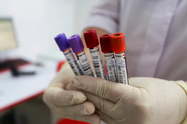 Доктор Вялов рассказал, в каких случаях можно получить ложный сигнал о раке