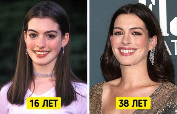 Знаменитые женщины, которые отказались от уколов красоты