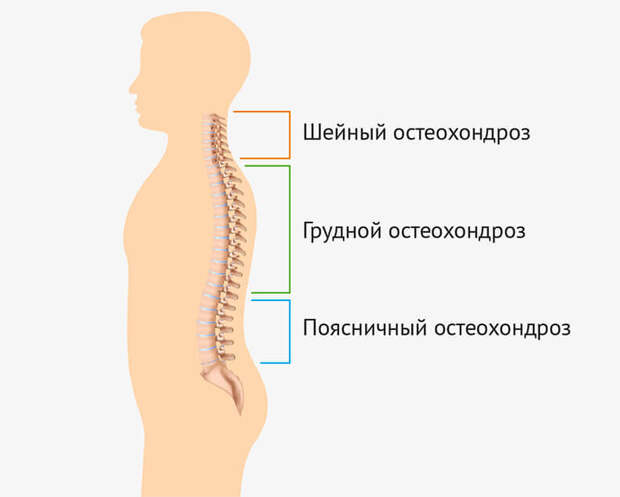 Беспредел бездействия, или Законы остеохондроза