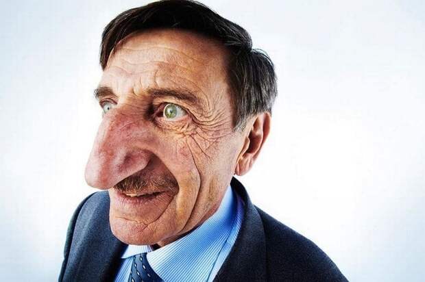 Буратино в реальной жизни: человек с самым длинным носом в мире