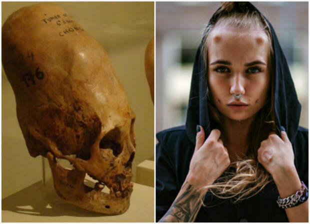 Искусственные модификации черепа. | Фото: The Flow, BlogNews.am.