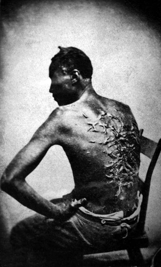 Бывший раб показывает свои шрамы от битья, штат Луизиана США, 1863 г. исторические фотографии, история, фото