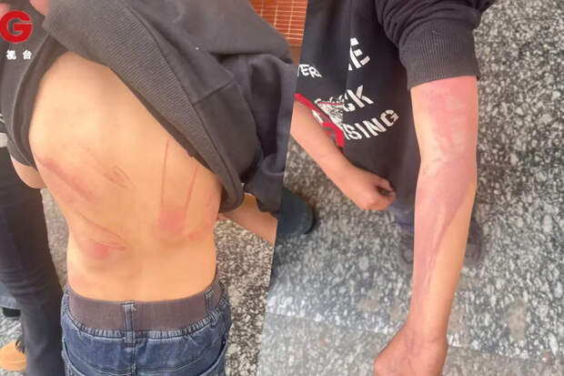 В Китае мальчика ошпаривала мальчика кипятком и заставляла есть фекалии