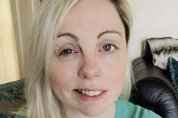 Mirror: у британки диагностировали паралич Белла накануне свадьбы