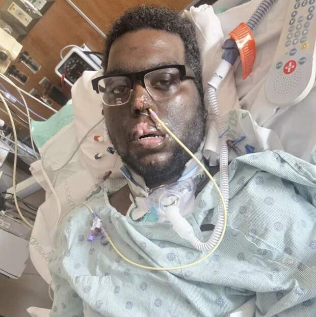 В США мужчина лишился конечностей после приема у стоматолога