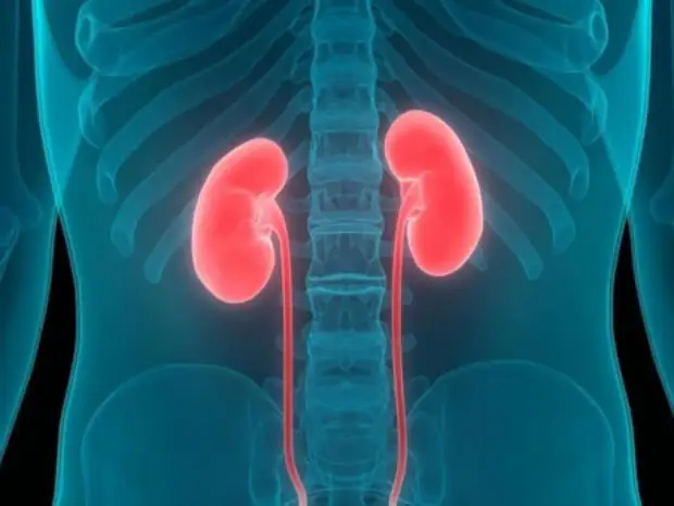 Врач: из-за жирного мяса и зелени могут появиться камни в почках