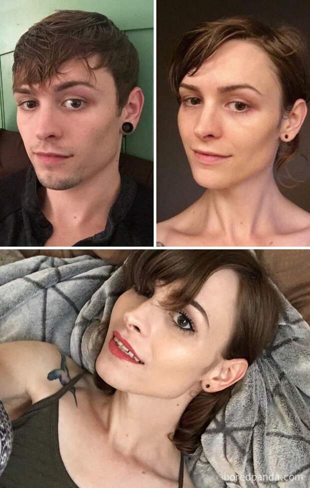 27-Year-Old Male To Female, 16 Months On HRT