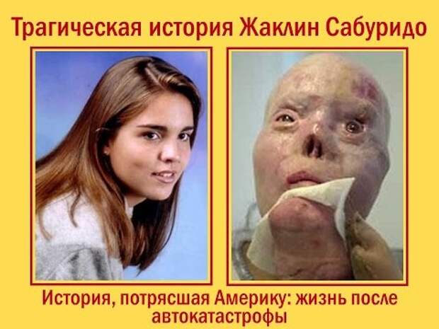 Трагическая история Жаклин Сабуридо. Трагическая история потрясшая Америку