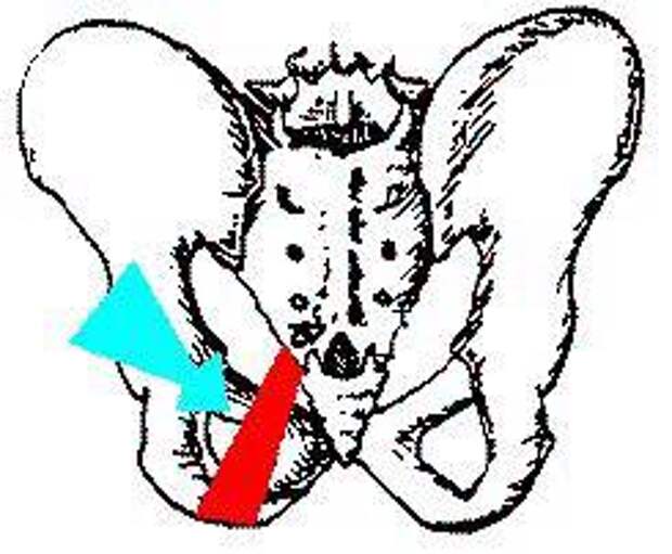 Сакротуберальная связка картинки