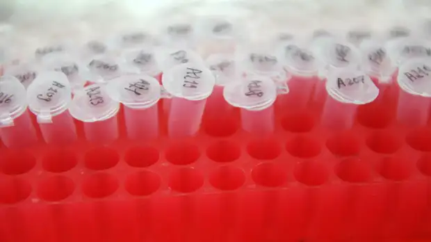 В Удмуртии подтвердили 213 случаев COVID-19 за сутки