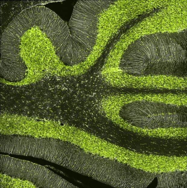 Победители конкурса микрофотогарфии Small World Photomicrography 2016